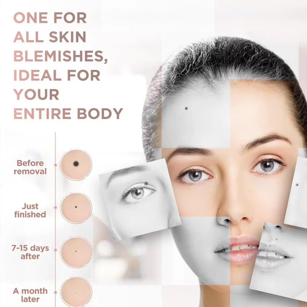 Nolani’s Beauty Plasma Pen